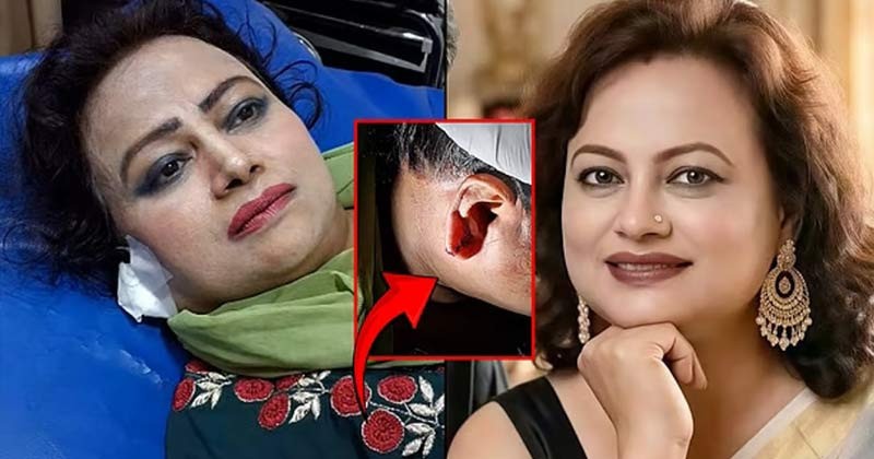 ছিনতাইকারীর হামলায় রঞ্জিতার কানে সাত সেলাই