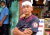 সমু চৌধুরীর ওপর হামলা, মাথায় চারটি সেলাই সমু চৌধুরীর ওপর হামলা, মাথায় চারটি সেলাই